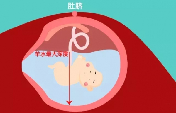 孕四个月羊水会漏吗，原因、预防与处理