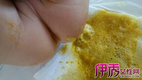 探究两个月婴儿大便出现泡沫的原因与应对之策