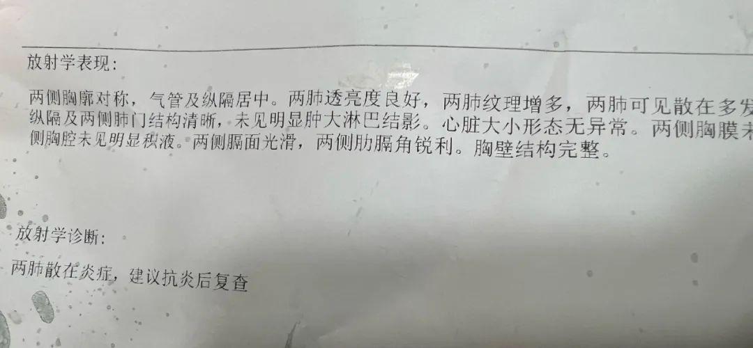 两个月内两次CT扫描，经历与反思